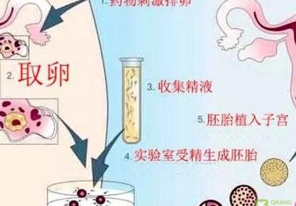 详细解读老河口市做长方案试管婴儿费用，长方案和短方案成功率有差别吗？