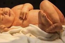 助孕新选择！试管婴儿长周期与短周期方案优缺点全解析