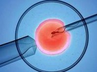 厦门有做第三代试管婴儿的医院吗？